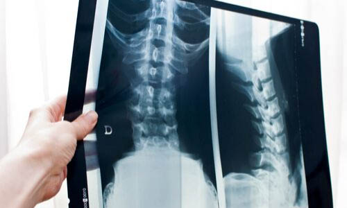 Back x ray - Emma Clark